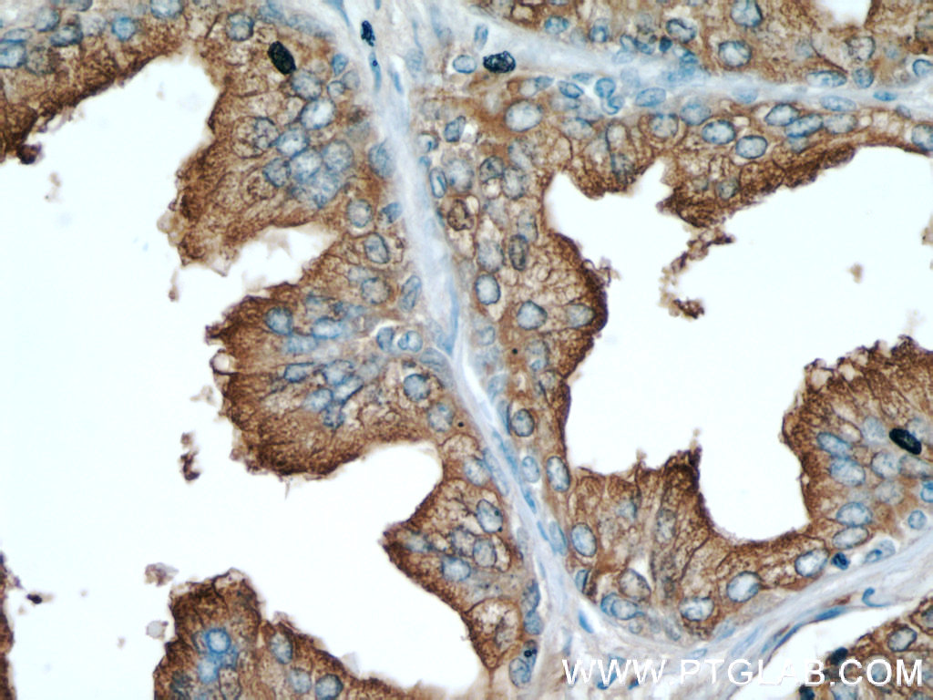 ACPP Monoclonal antibody