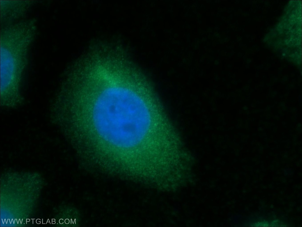 CKM-Specific Monoclonal antibody