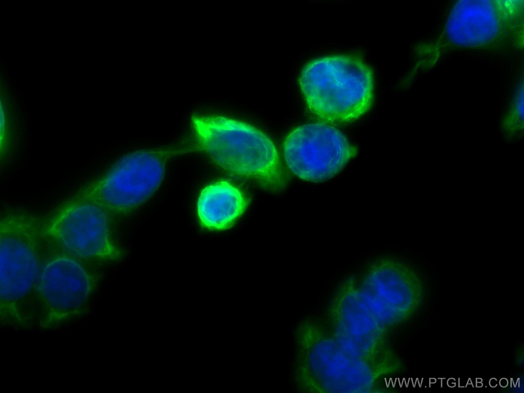 Cytokeratin 20 Monoclonal antibody