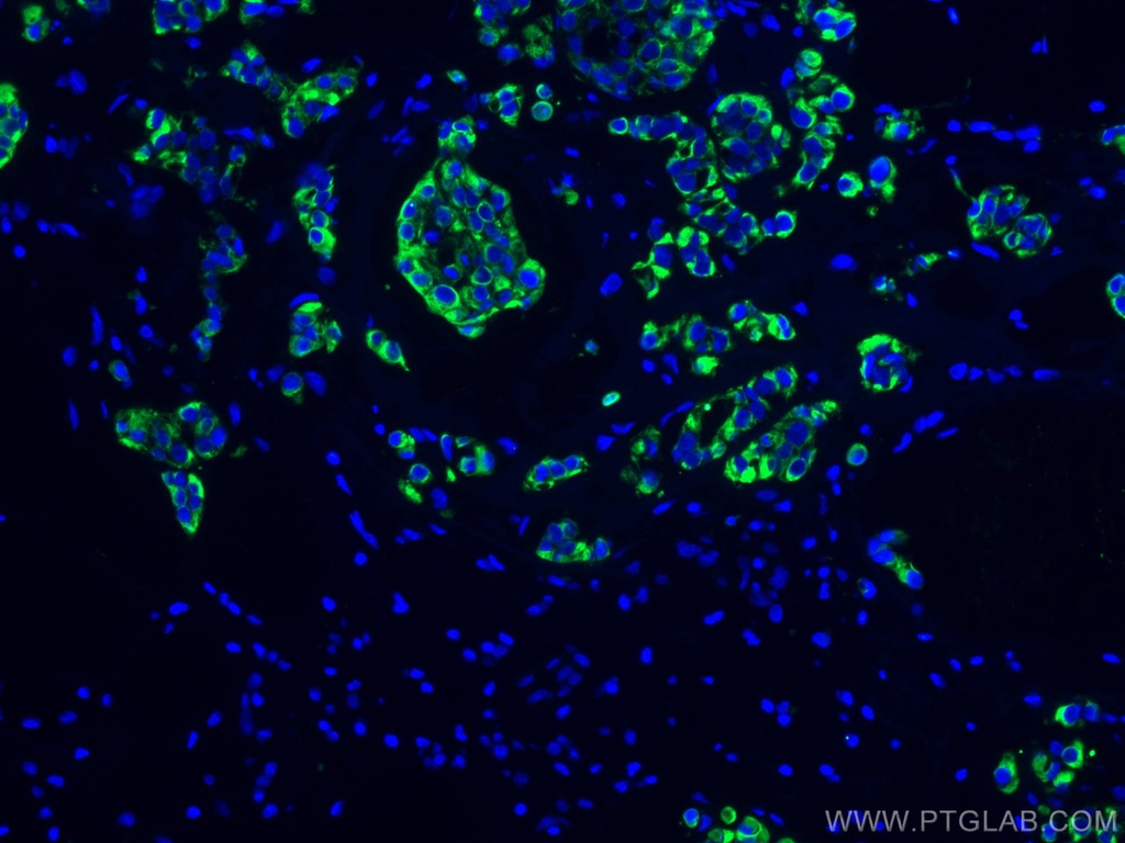 Cytokeratin 19 Monoclonal antibody