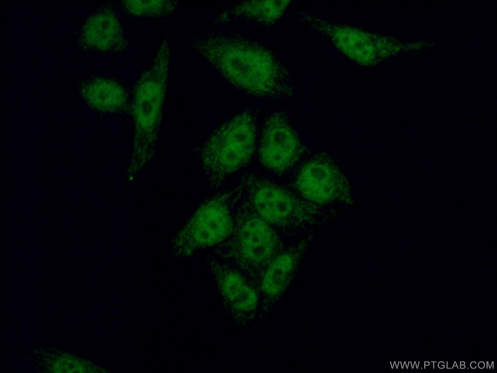 WTAP Monoclonal antibody