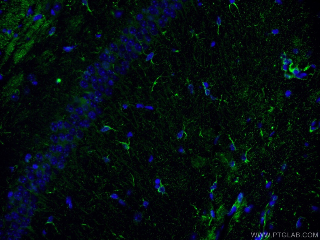 NF-L Monoclonal antibody