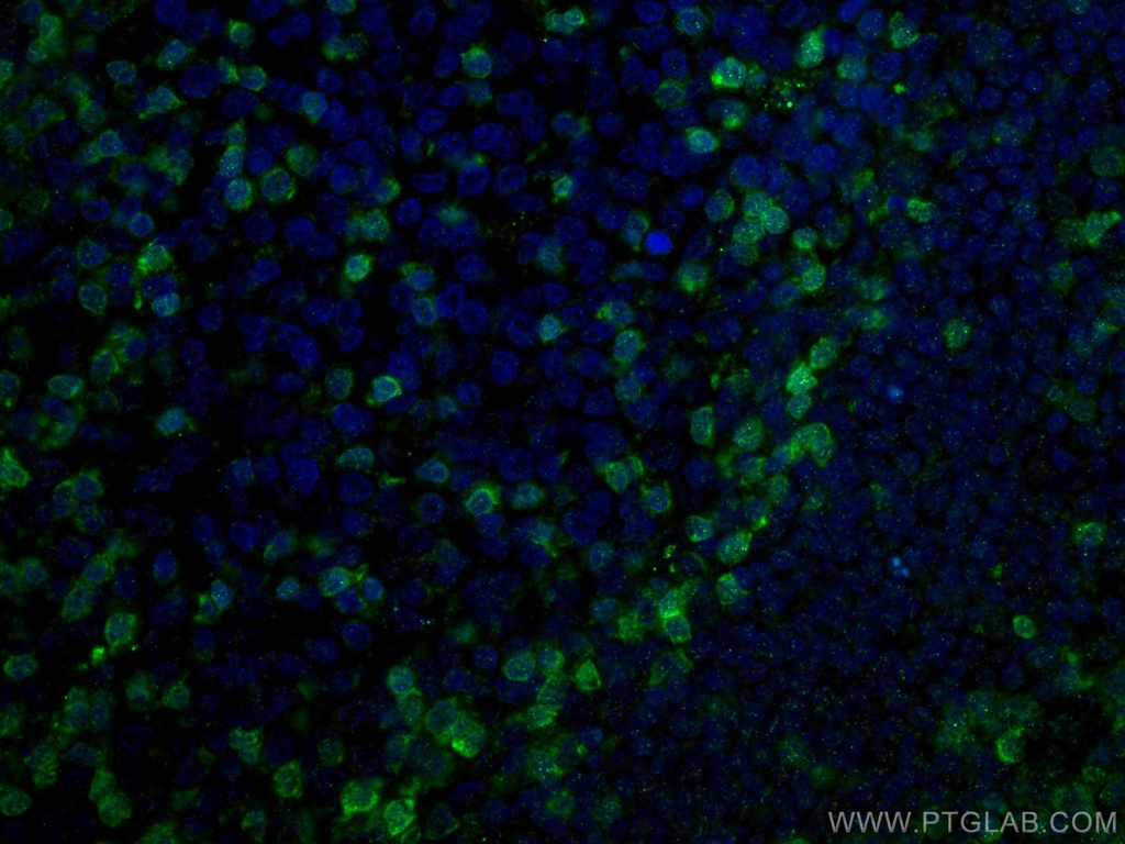 ZAP70 Monoclonal antibody