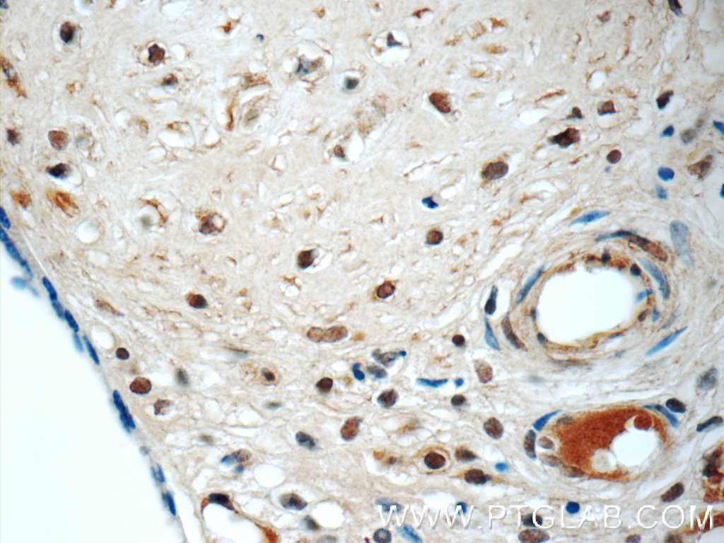 LYN Monoclonal antibody