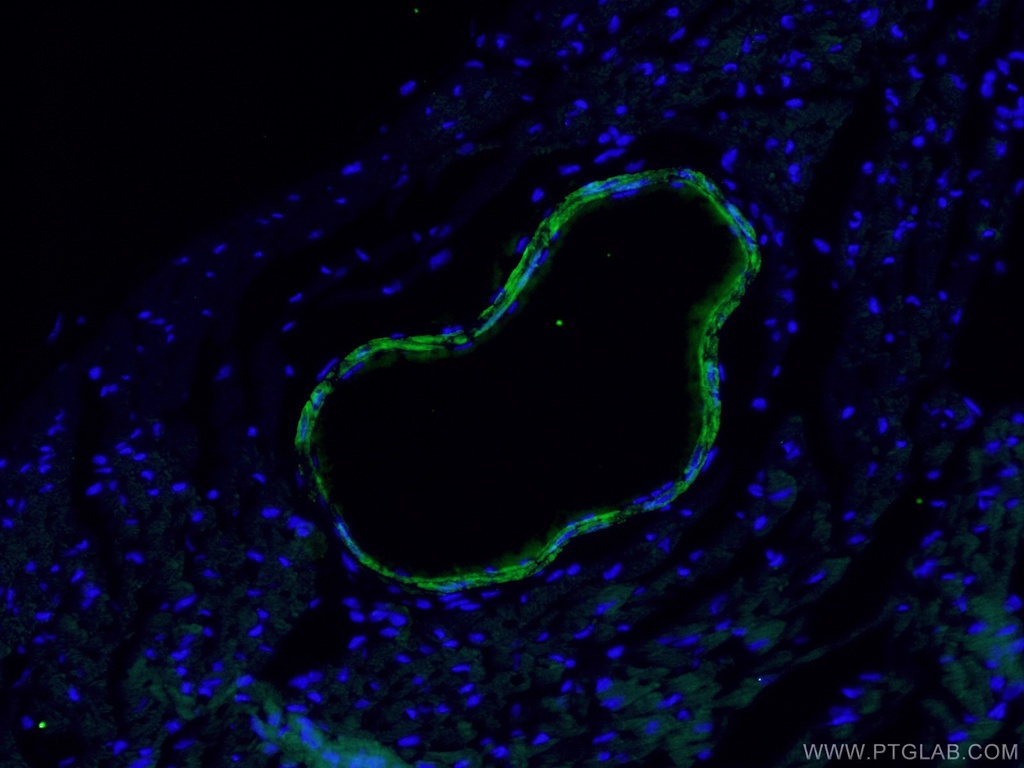 transgelin/SM22 Monoclonal antibody