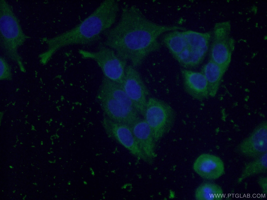 Cytoglobin Monoclonal antibody