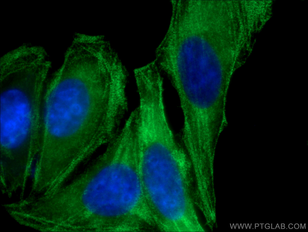 MYH9 Monoclonal antibody