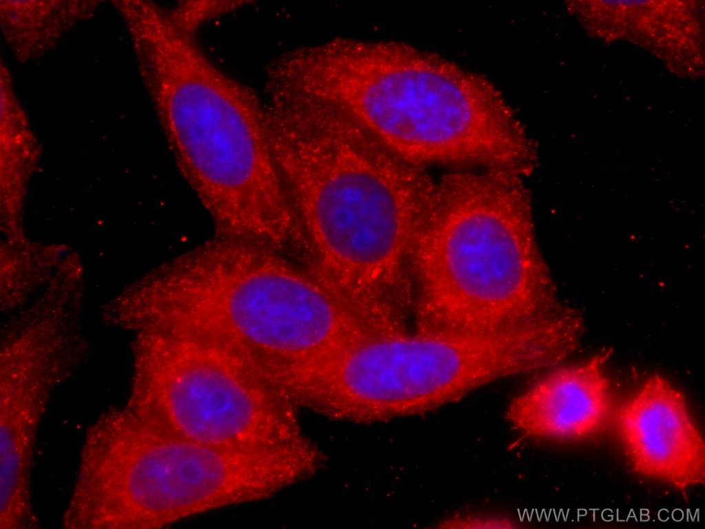 COTL1 Monoclonal antibody