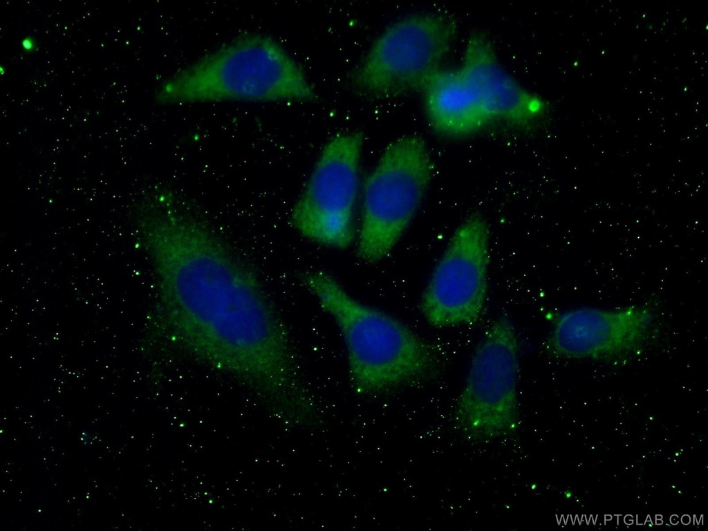 4EBP1 Monoclonal antibody