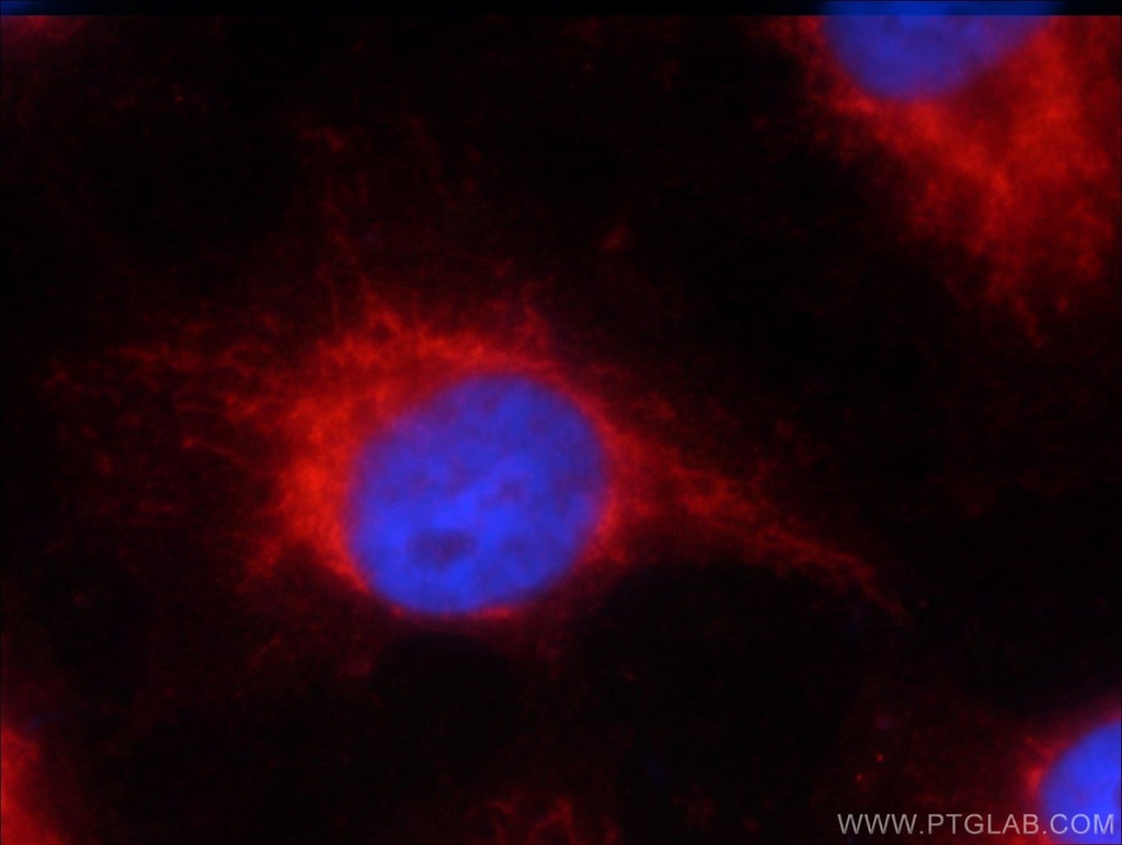 Napsin A Monoclonal antibody