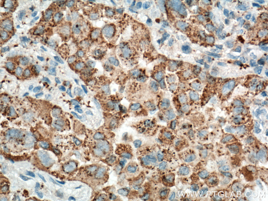 Napsin A Monoclonal antibody