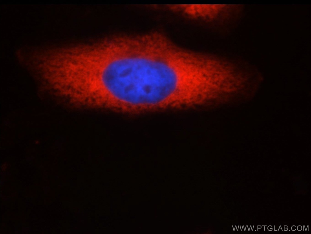 SND1 Monoclonal antibody