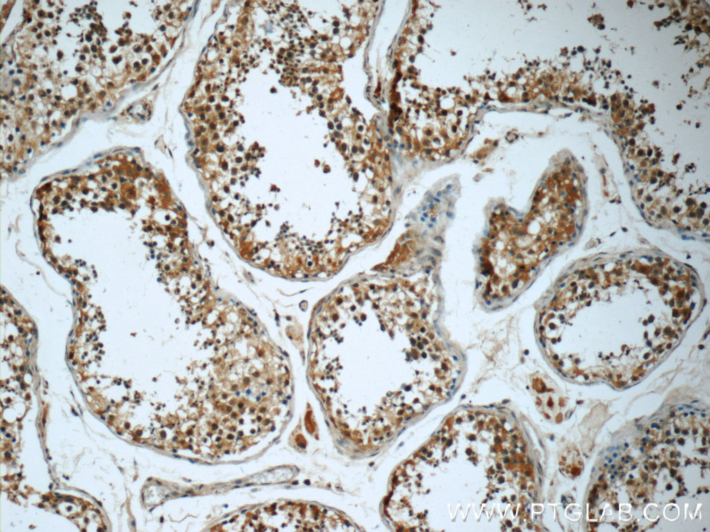 KIFAP3 Monoclonal antibody