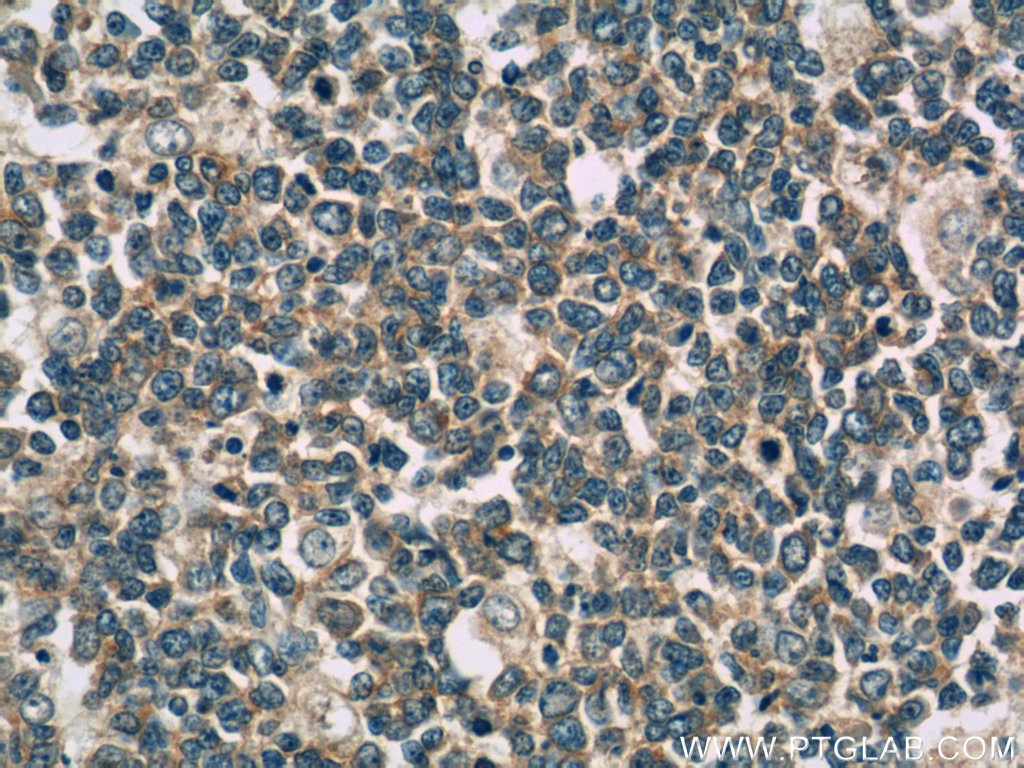 IL-28A Monoclonal antibody