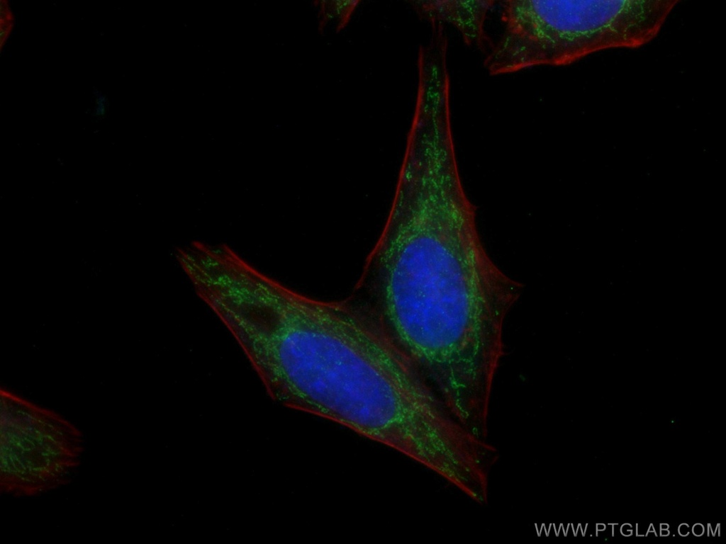 ATP5C1 Monoclonal antibody