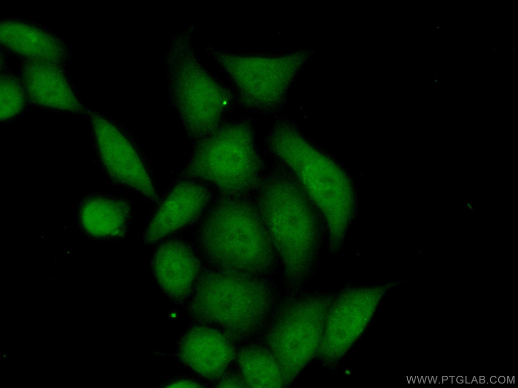 Annexin IV Monoclonal antibody