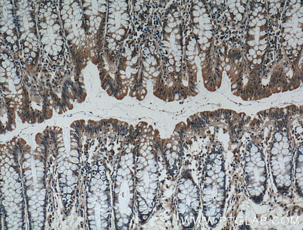 IL-37 Monoclonal antibody