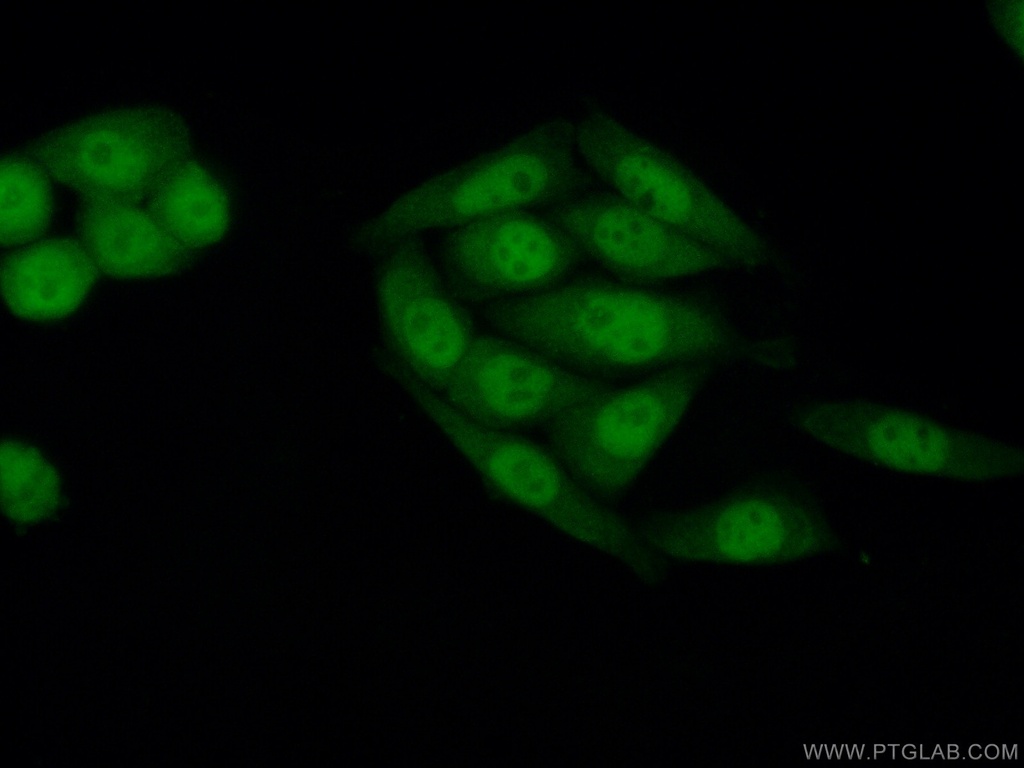 SIRT1 Monoclonal antibody