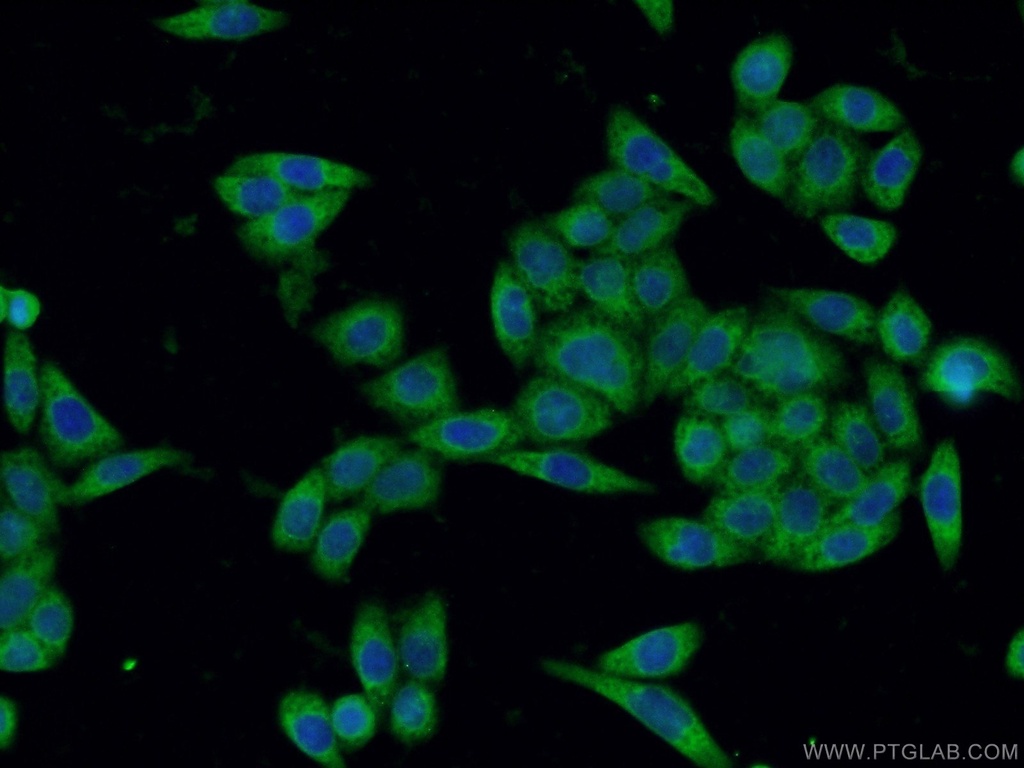 SGTA Monoclonal antibody
