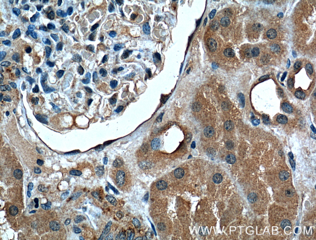 FOLR1 Monoclonal antibody