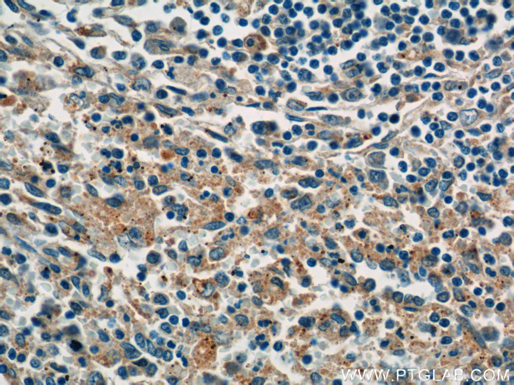 P-selectin Monoclonal antibody