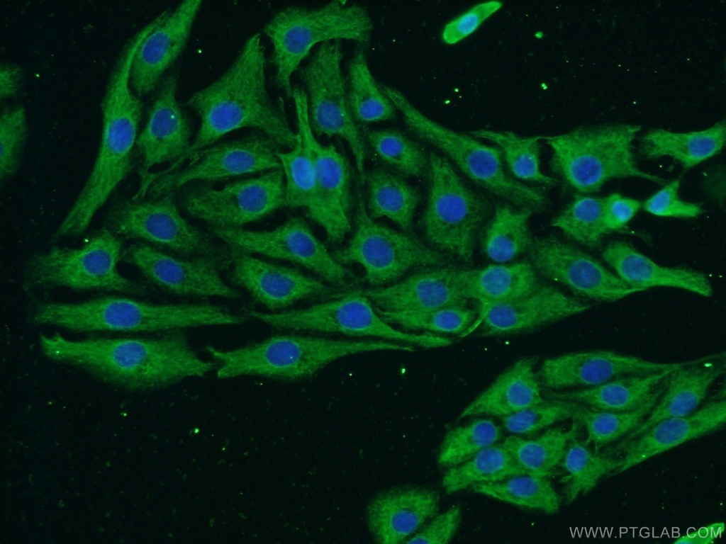 NF-H Monoclonal antibody