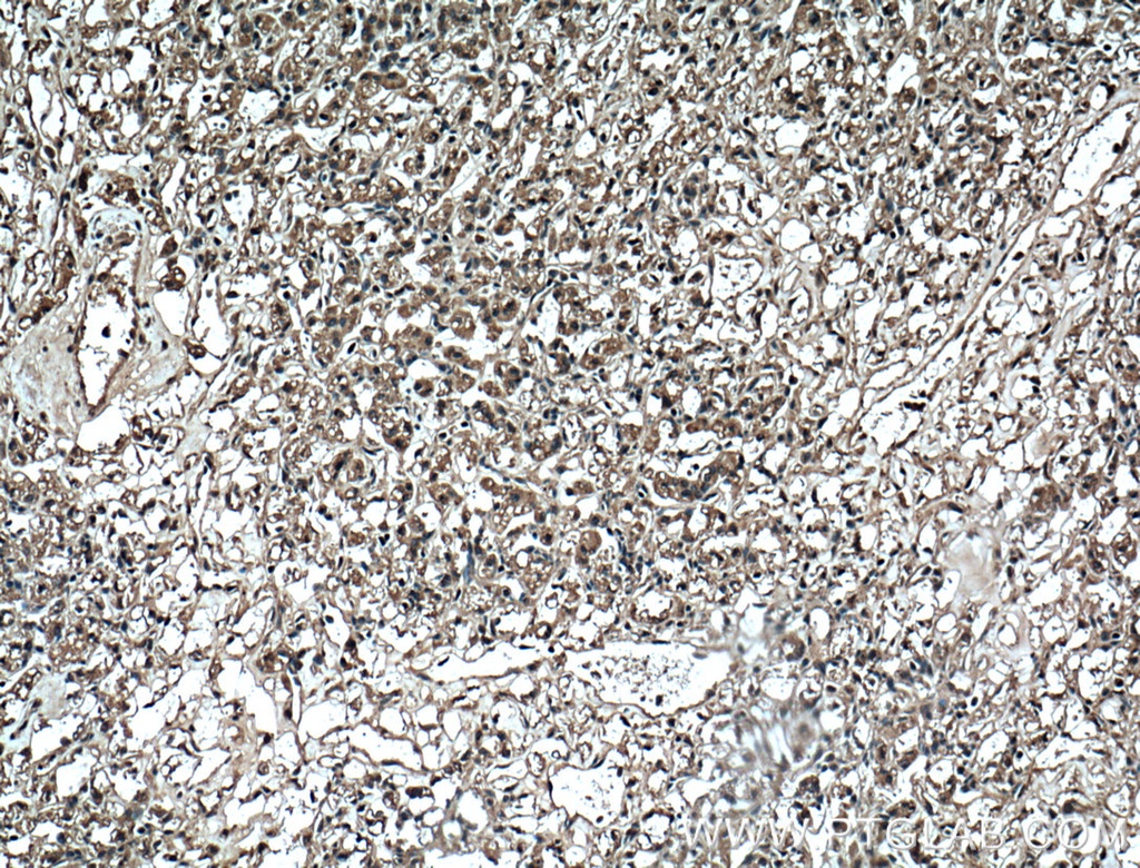 ADRP/Perilipin 2 Monoclonal antibody