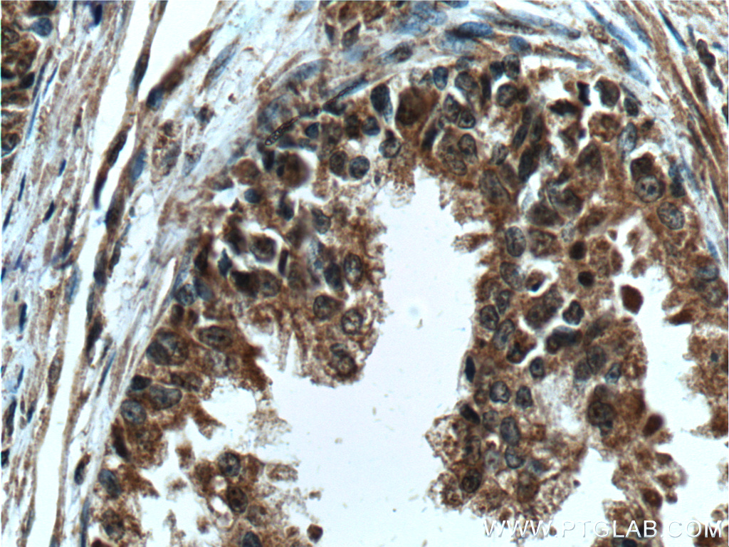 LIN28 Monoclonal antibody