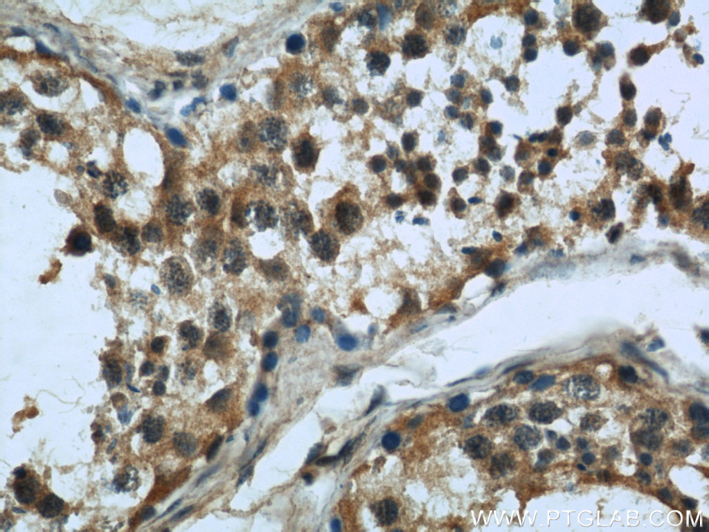 MAD2L1 Monoclonal antibody