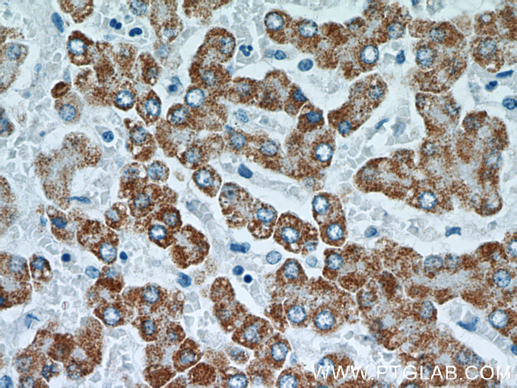 TST Monoclonal antibody