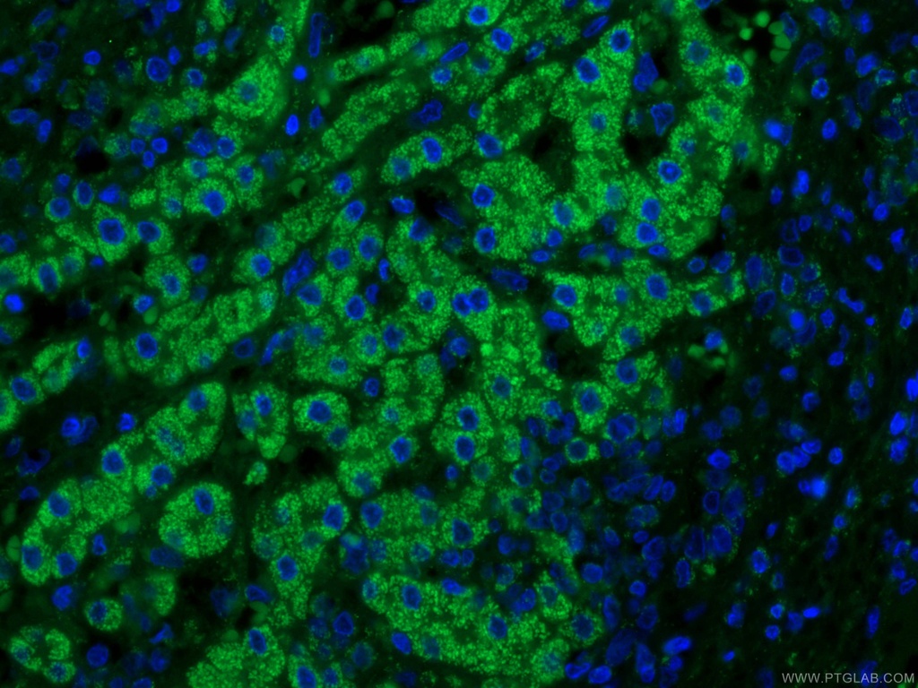 IVD Monoclonal antibody