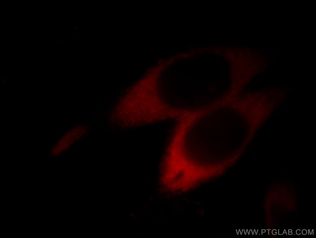 ASS1 Monoclonal antibody