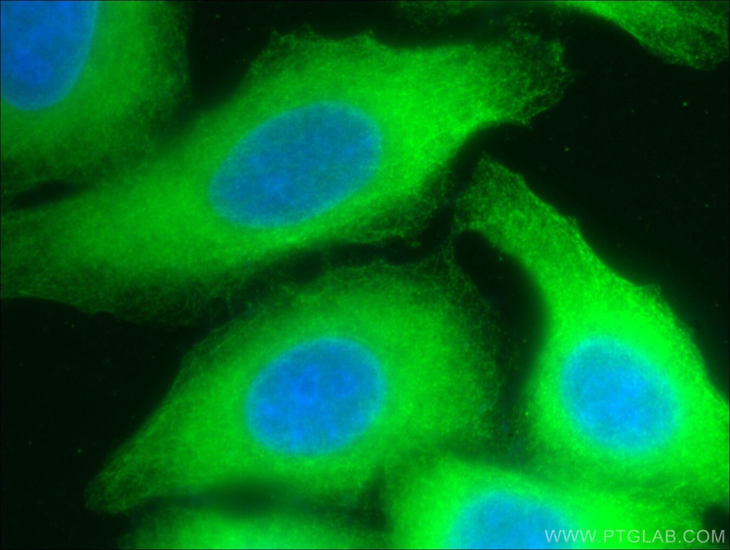 RPS3 Monoclonal antibody
