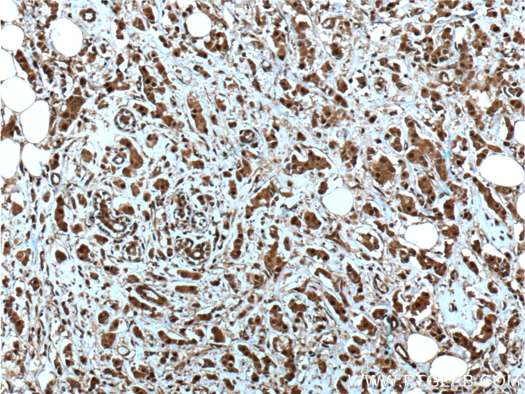 NOB1 Monoclonal antibody