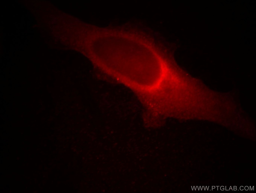 MMS19 Monoclonal antibody