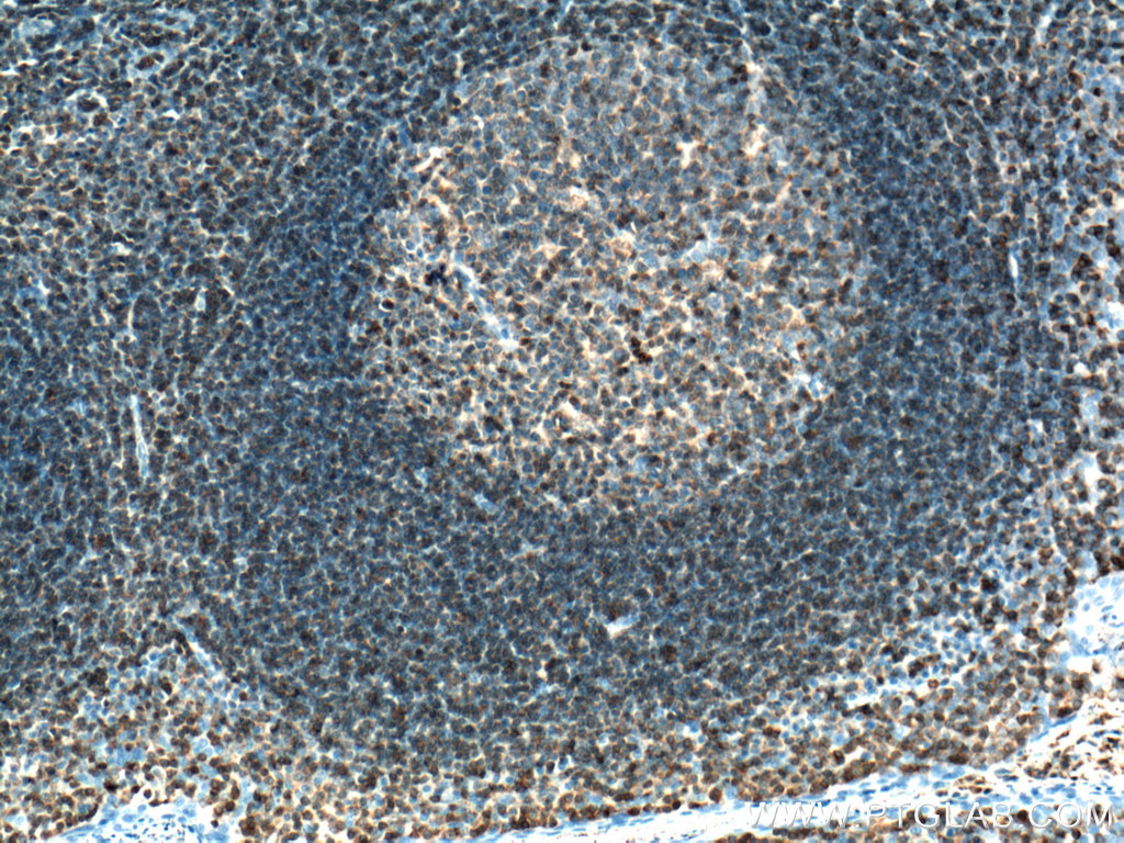 ARHGDIB Monoclonal antibody