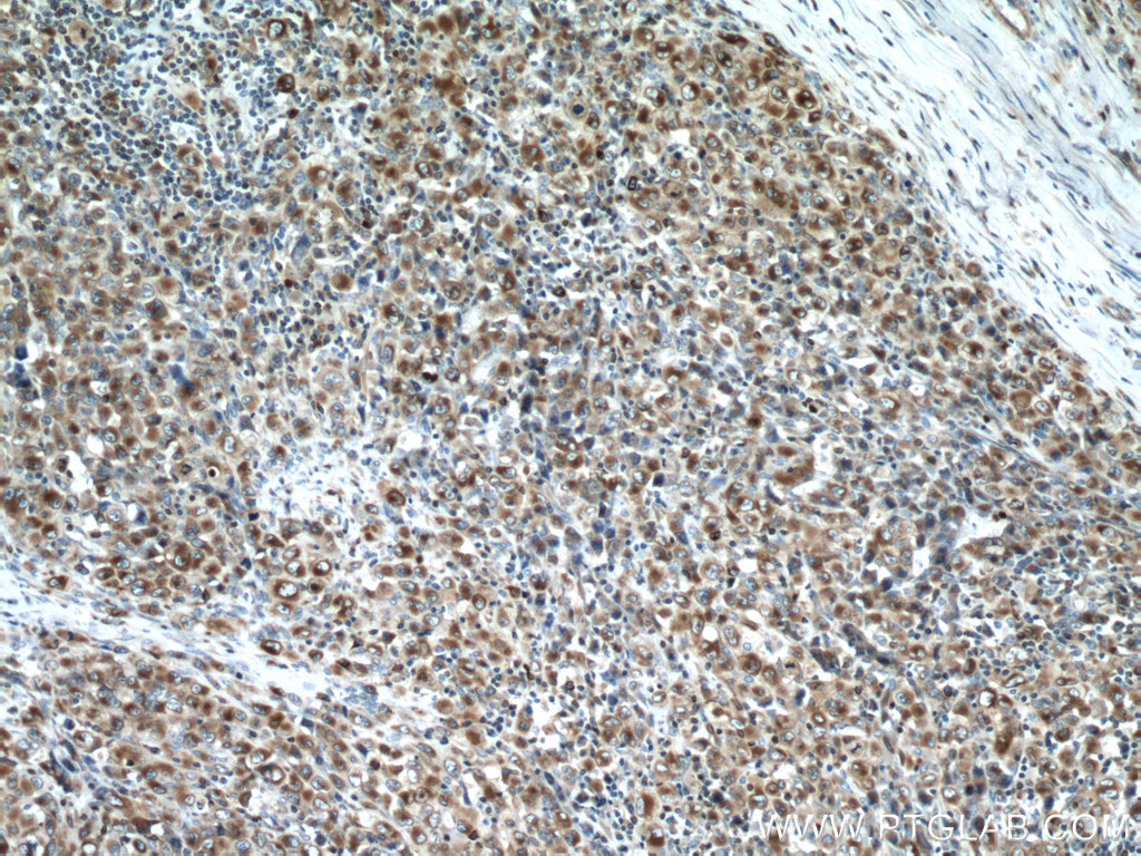 RAB27A Monoclonal antibody