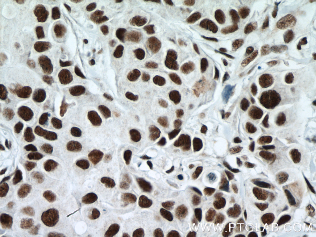 RBM15 Monoclonal antibody