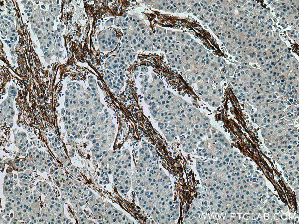 Caveolin-1 Monoclonal antibody