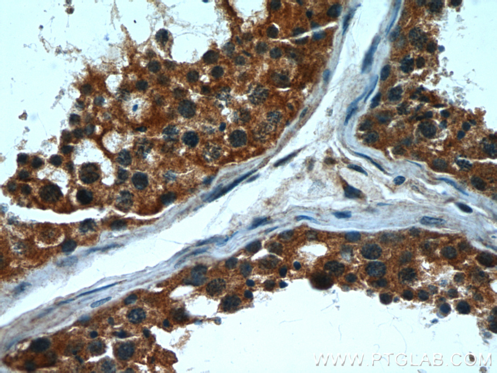 CPT1C Monoclonal antibody