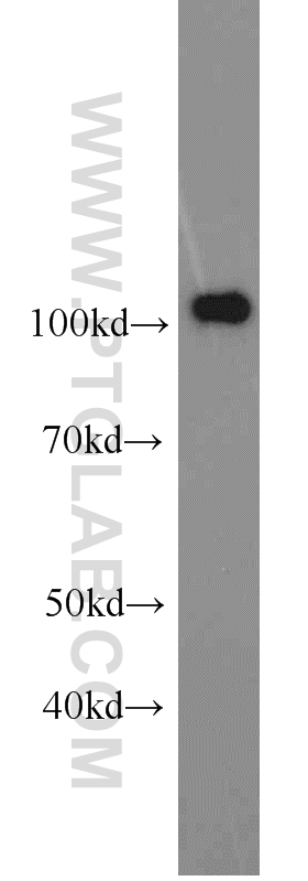PMS2 Monoclonal antibody