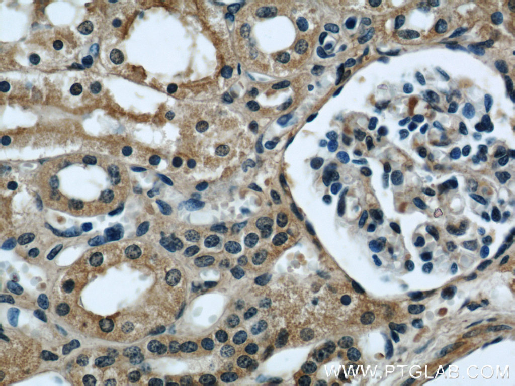 Serum amyloid P component Monoclonal antibody