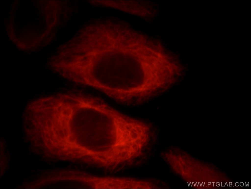 Villin Monoclonal antibody