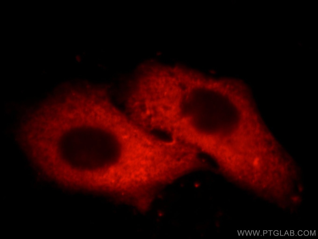 ORM1/2 Monoclonal antibody
