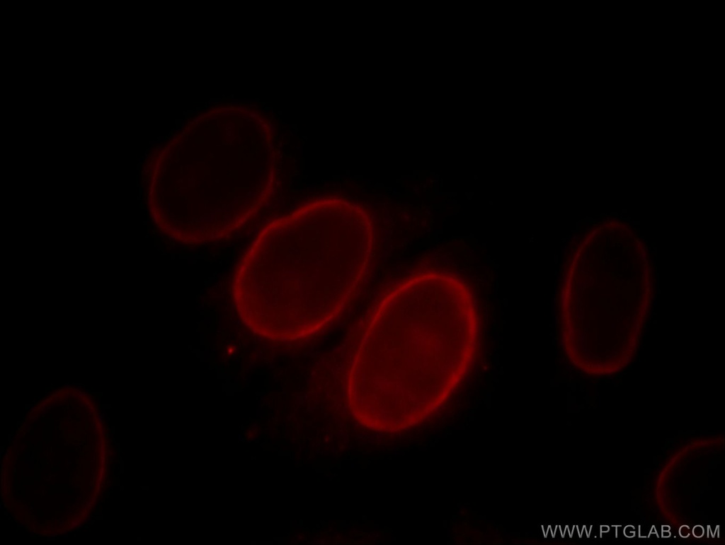 S100A6 Monoclonal antibody