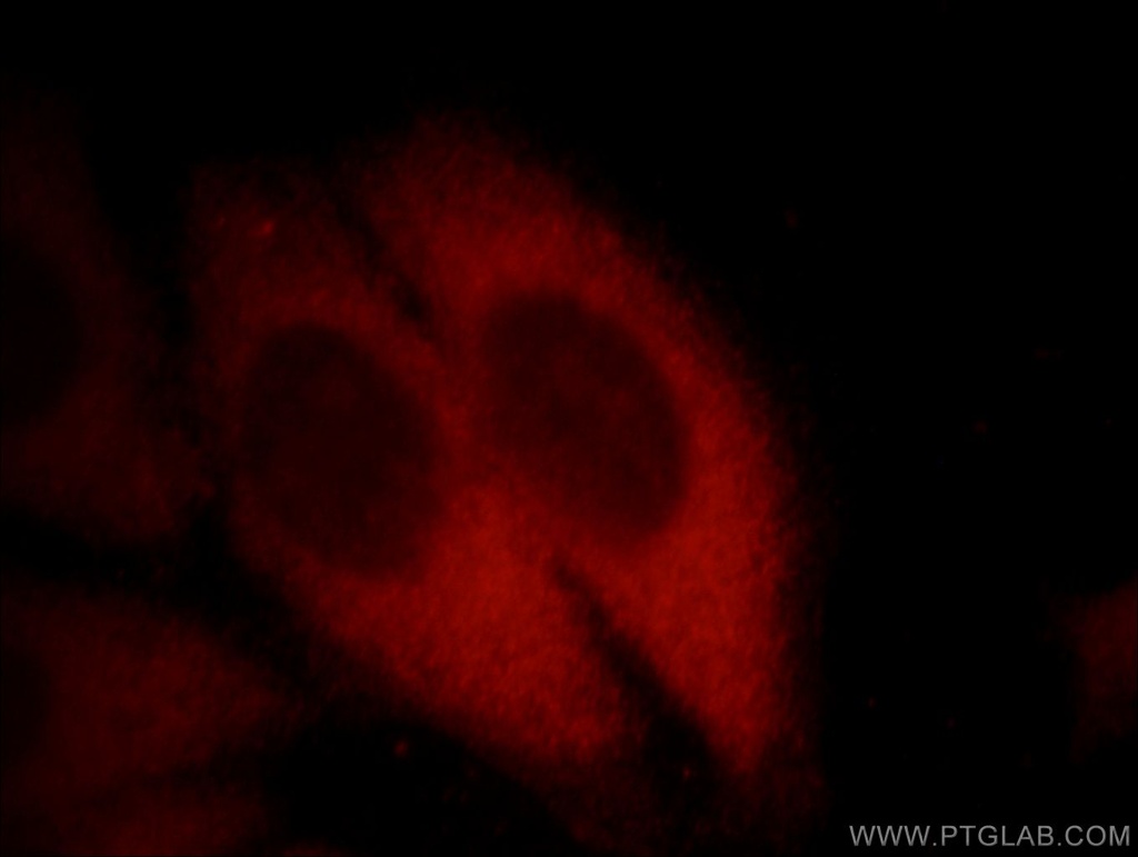 EXOSC2 Monoclonal antibody