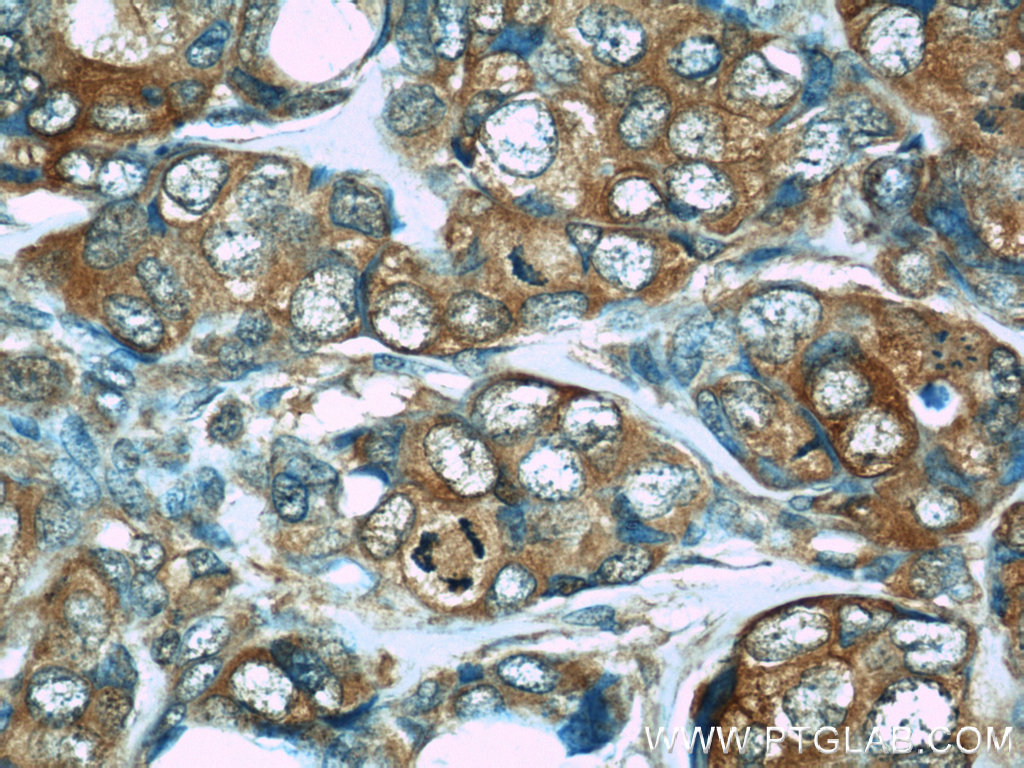 PDCD4 Monoclonal antibody