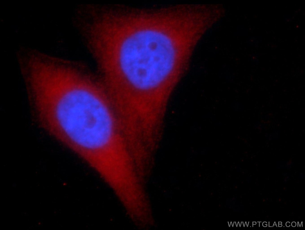 PGM1 Monoclonal antibody