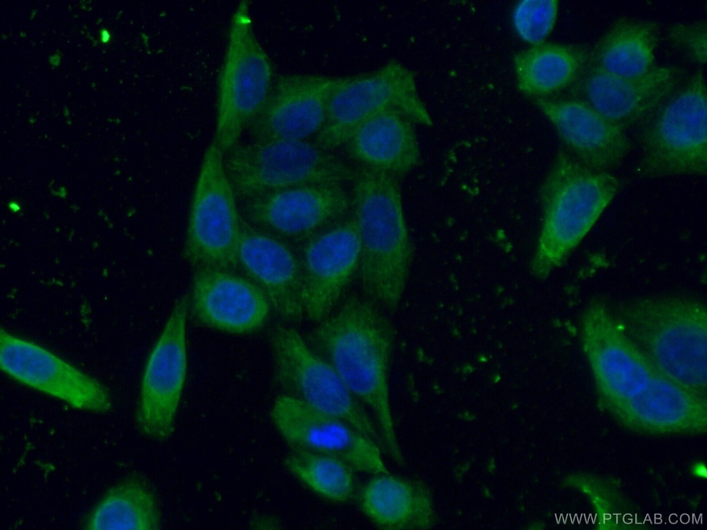 AFM Monoclonal antibody