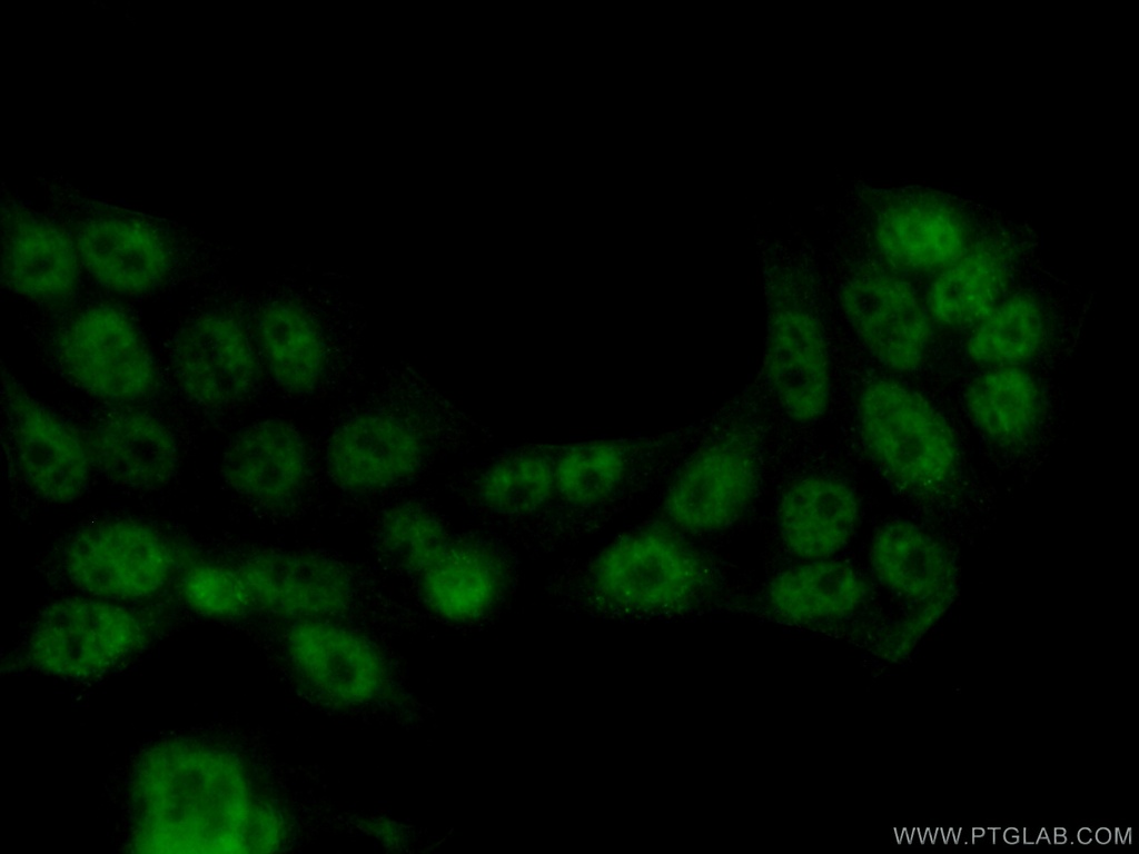 TFIP11 Monoclonal antibody